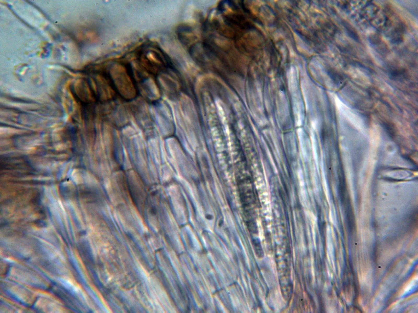 Microscopía de Peltigera praetextata - 7 - Asco y paráfisis 1